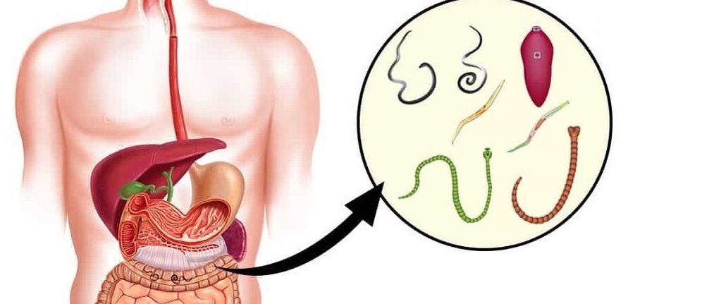 Paraziti u ljudskom tijelu