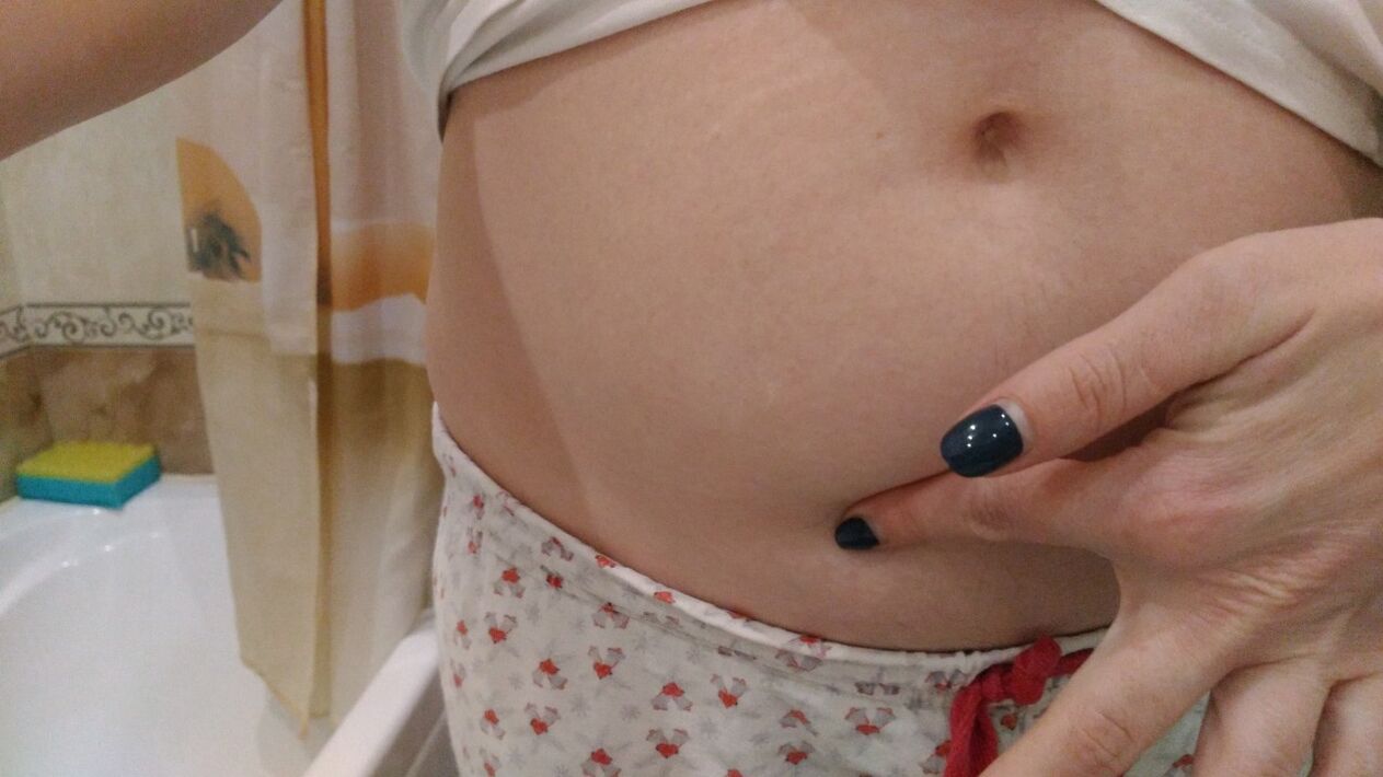 Znakovi infekcije helmintima iz osobnog iskustva