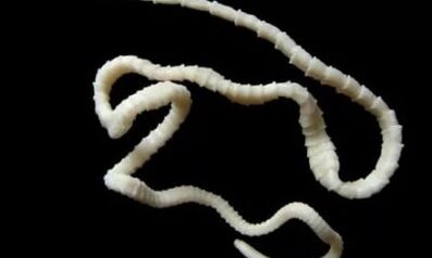 kako ukloniti parazita cestode iz tijela