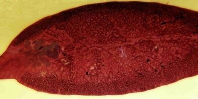 parazit trematoda kako ukloniti iz tijela