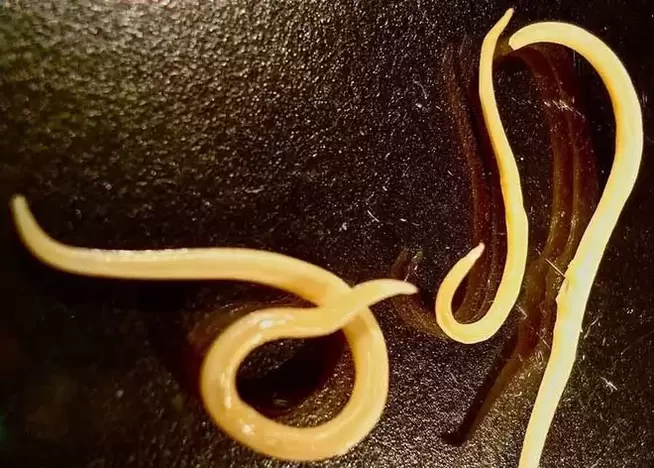 protozojski parazit iz ljudskog tijela